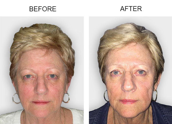 Lakeland Cosmetic Facial Surgery